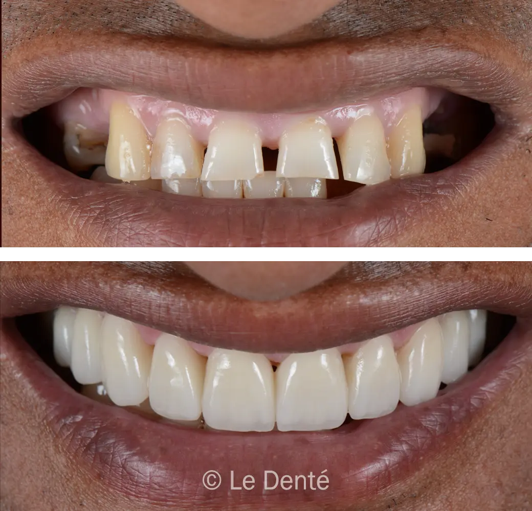 Digital Smile Design Solutions