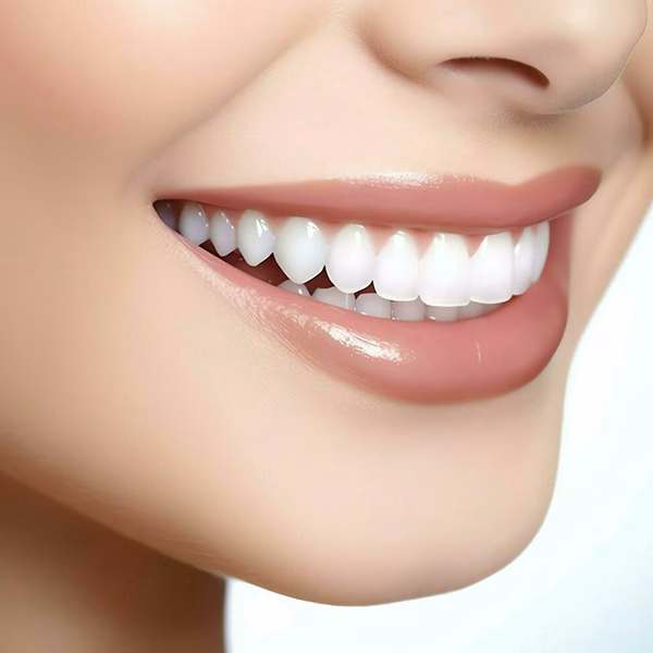 Signs You Need Professional Teeth Whitening