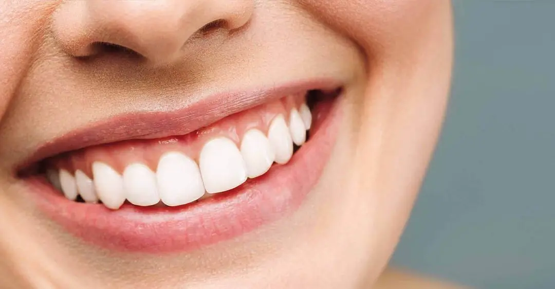 Precision in Every Smile